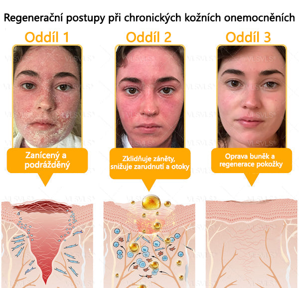 🐝Twisma® Krém s včelím jedem – doporučeno kožními lékaři 🧑‍⚕️ Na různé kožní problémy – fakt účinný a šetrný pomocník