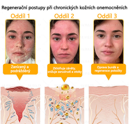 🐝Twisma® Krém s včelím jedem – doporučeno kožními lékaři 🧑‍⚕️ Na různé kožní problémy – fakt účinný a šetrný pomocník