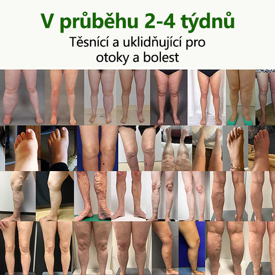 🌿 🌿Řekněte sbohem oteklým, bolestivým nohám – CleraNaure® FluidEase Profesionální krém pro prokrvení nohou přináší skutečnou úlevu! ✨🦵