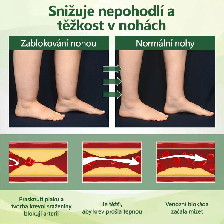 🌿 🌿Řekněte sbohem oteklým, bolestivým nohám – CleraNaure® FluidEase Profesionální krém pro prokrvení nohou přináší skutečnou úlevu! ✨🦵