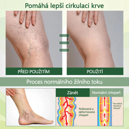 🌿 🌿Řekněte sbohem oteklým, bolestivým nohám – CleraNaure® FluidEase Profesionální krém pro prokrvení nohou přináší skutečnou úlevu! ✨🦵