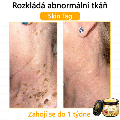 🐝Twisma® Krém s včelím jedem – doporučeno kožními lékaři 🧑‍⚕️ Na různé kožní problémy – fakt účinný a šetrný pomocník