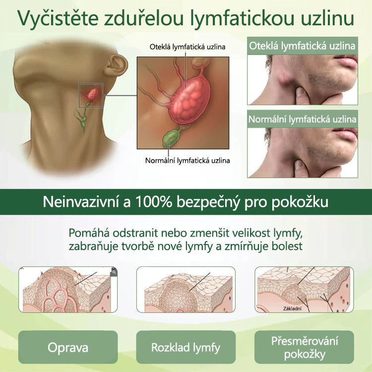 🌿 🌿Řekněte sbohem oteklým, bolestivým nohám – CleraNaure® FluidEase Profesionální krém pro prokrvení nohou přináší skutečnou úlevu! ✨🦵