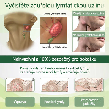🌿 🌿Řekněte sbohem oteklým, bolestivým nohám – CleraNaure® FluidEase Profesionální krém pro prokrvení nohou přináší skutečnou úlevu! ✨🦵