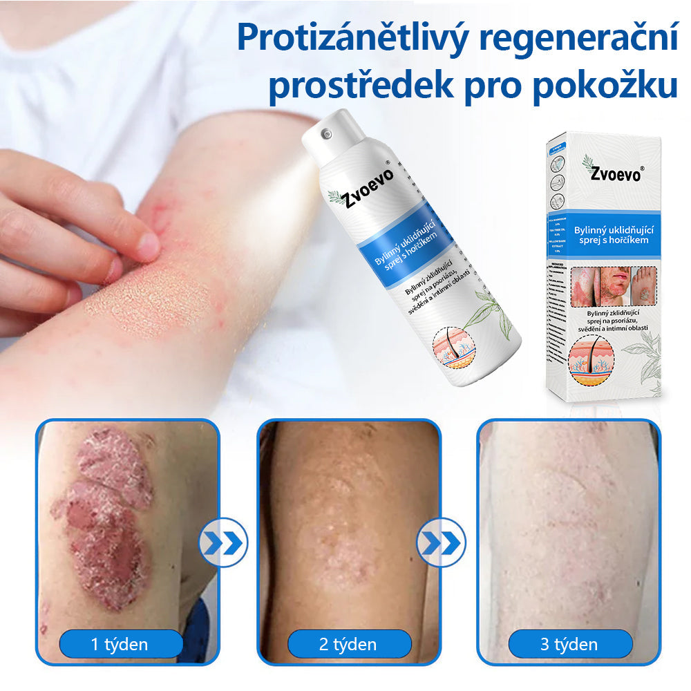 💪 Oficiální obchod: Twisma® Magnesium bylinný sprej na lupénku ✅ CE certifikace (zmírňuje lupénku a ekzém, léčí akné a bradavice, podporuje hojení bakteriálních infekcí, snižuje kloubní a neuropatickou bolest)