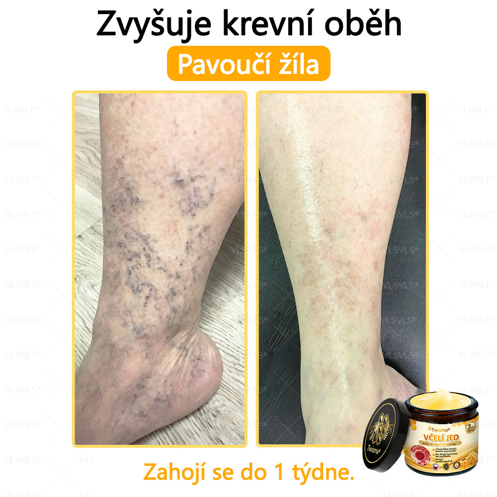 🐝Twisma® Krém s včelím jedem – doporučeno kožními lékaři 🧑‍⚕️ Na různé kožní problémy – fakt účinný a šetrný pomocník